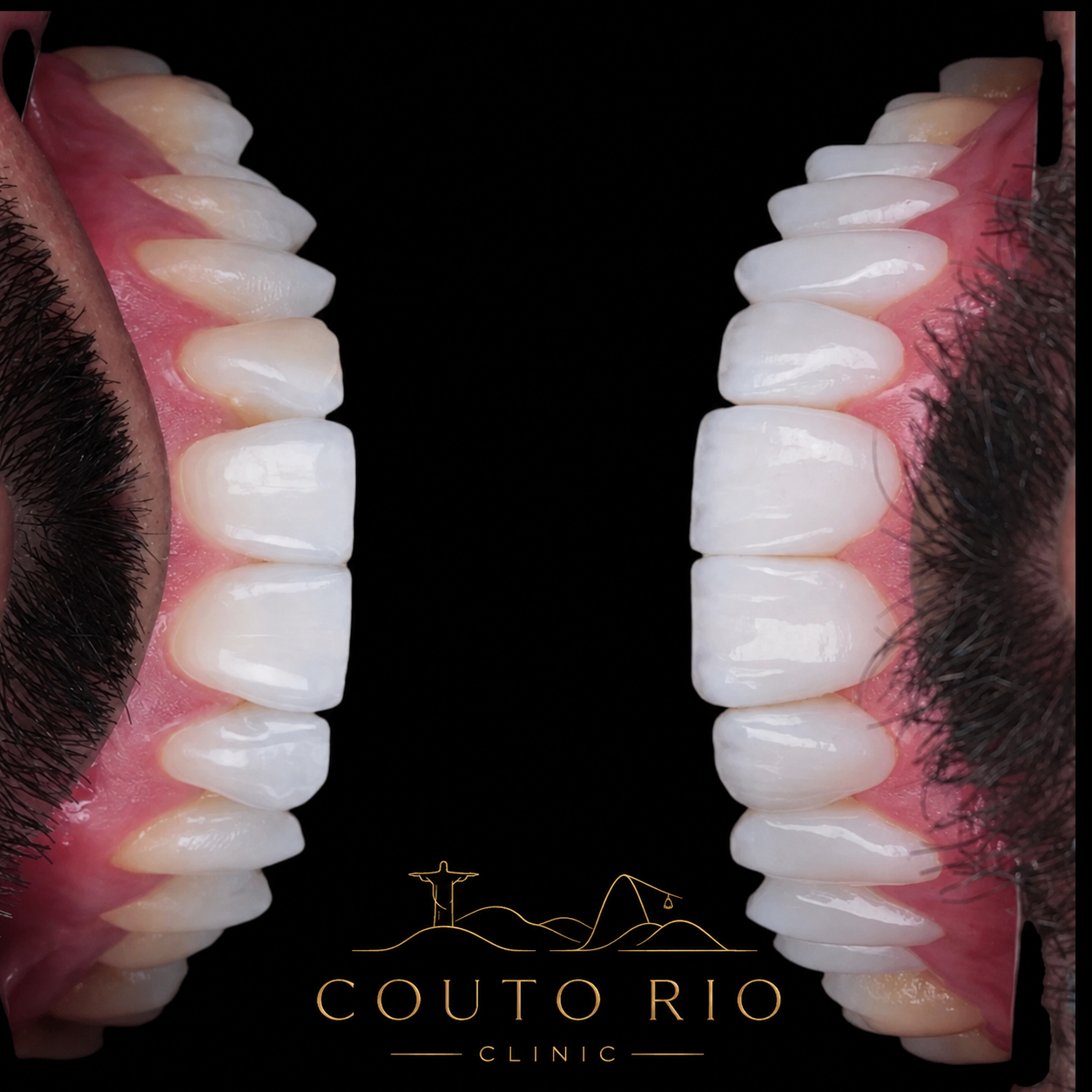 Resultado Couto Rio Clinic 3